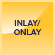 Inlay-Onlay